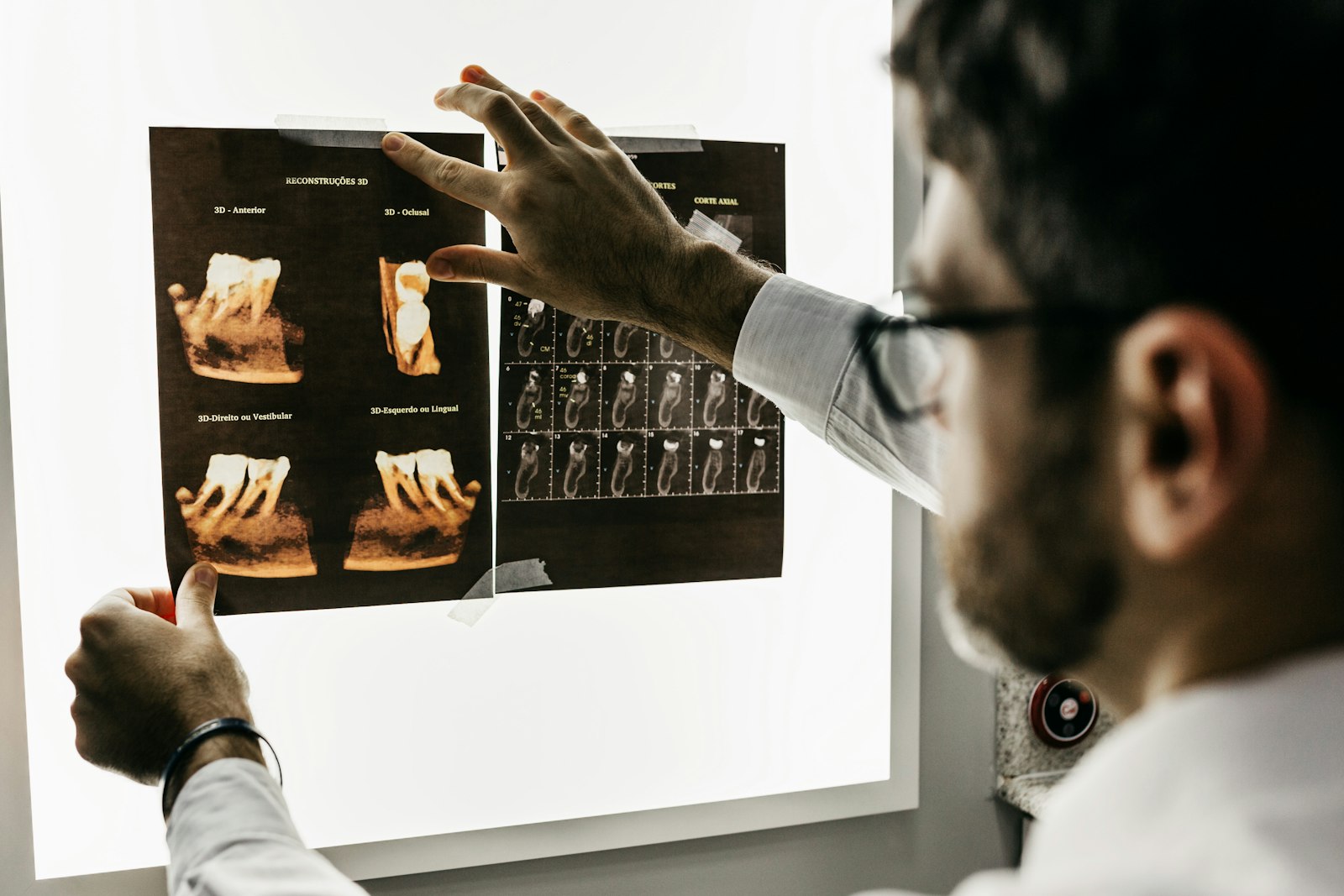 Estudio radiográfico para implantes